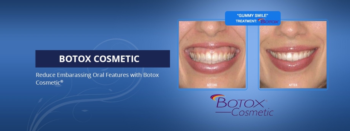 botox slider
